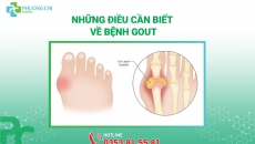 Những Điều Cần Biết Về Bệnh Gout