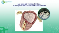 Đau Bụng Bất Thường Ở Trẻ Em: Cẩn Thận Với Viêm Hoại Tử Bờm Mỡ Đại Tràng