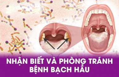 Chủ động phòng chống bệnh Bạch Hầu