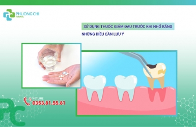 Sử Dụng Thuốc Giảm Đau Trước Khi Nhổ Răng: Những Điều Cần Lưu Ý