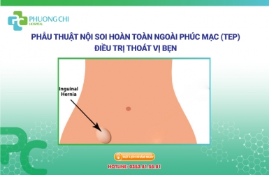 Phẫu thuật nội soi hoàn toàn ngoài phúc mạc (TEP) điều trị thoát vị bẹn