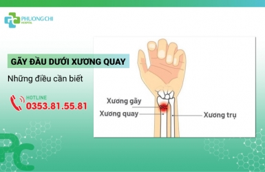 Gãy Đầu Dưới Xương Quay Và Những Điều Cần Biết