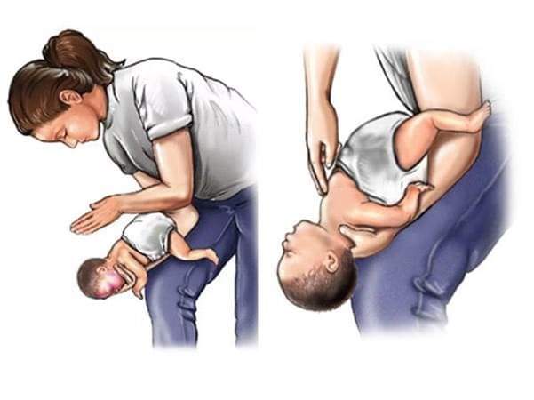 Sơ cứu trẻ dưới 2 tuổi bằng phương pháp vỗ lưng ấn ngực